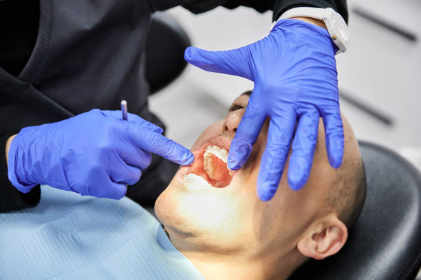 Best Emergency Dental Care for Broken or Chipped Teeth in Hood River, OR